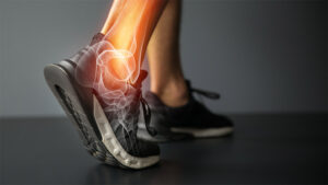 Senebetennelse behandles med stamceller på Medicura